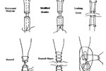 Drawing Tendon Sutures